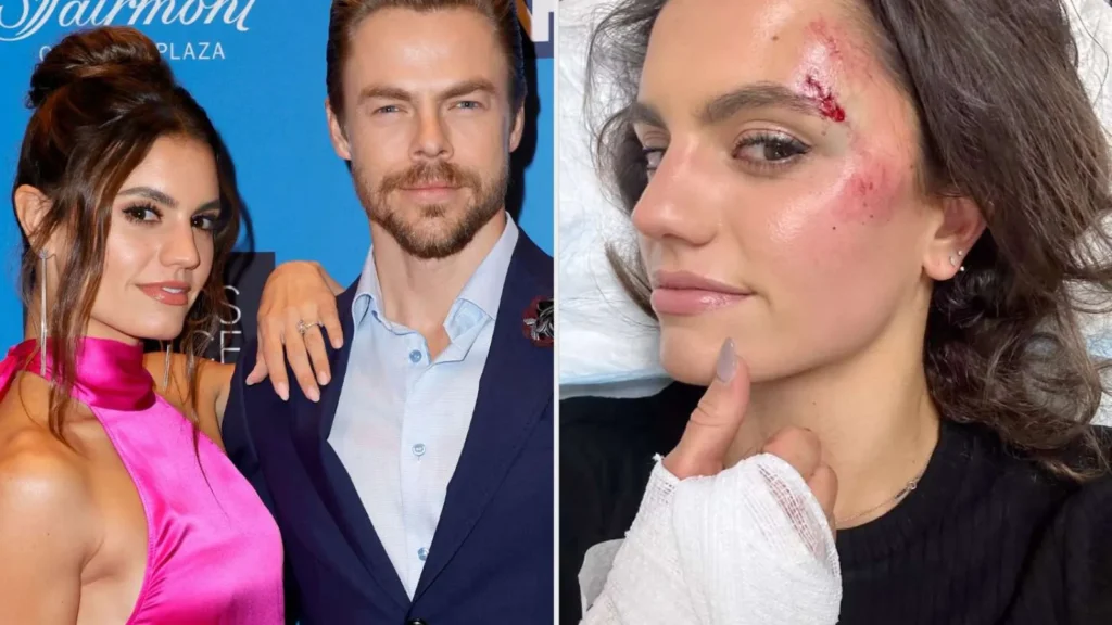 Derek Hough Wife Accident